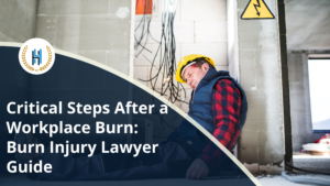 What to Do After Suffering a Burn Injury at Work: Immediate Steps and How a Burn Injury Lawyer Can Help