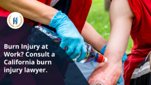 Why hire a lawyer immediately after a workplace burn injury when it is crucial?